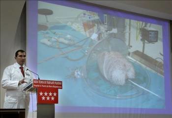 El especialista en cirugía torácica del hospital Puerta de Hierro Javier Moradiellos, durante la presentación. (Foto: EFE)