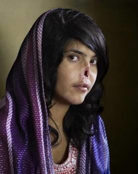 El retrato de Aisha, World Press Photo 2011
