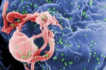 Virus del sida, VIH.