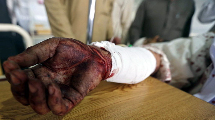 Un hombre recibe atención médica en un hospital en Peshawar