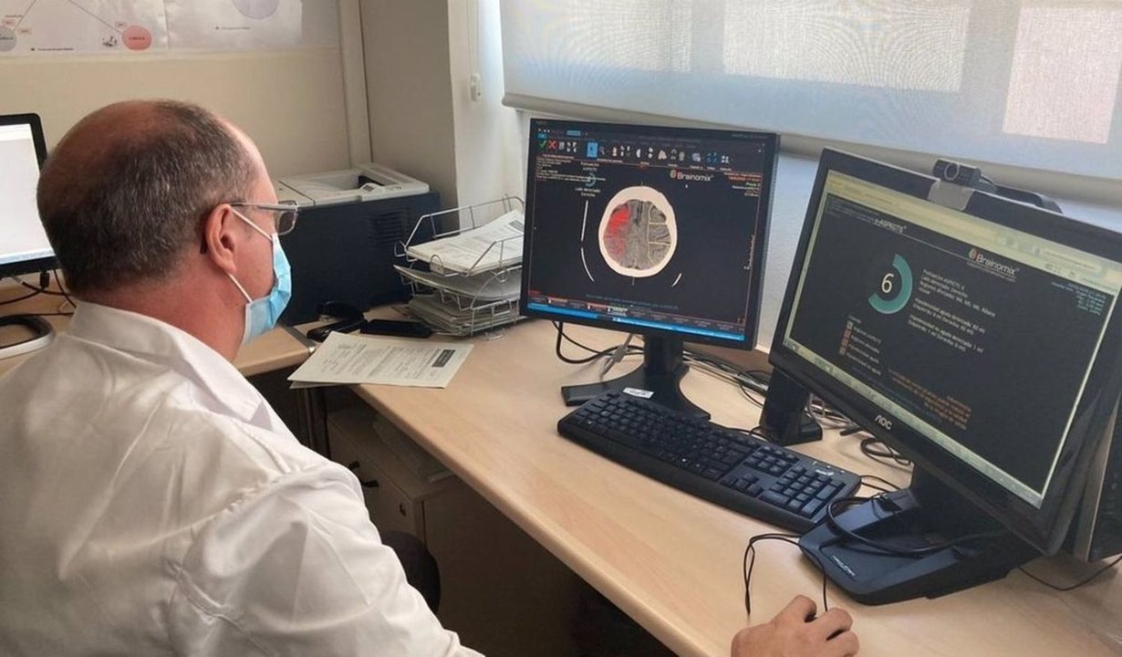 Un médico analiza en un ordenador una neuroimagen para tratar el ictus.