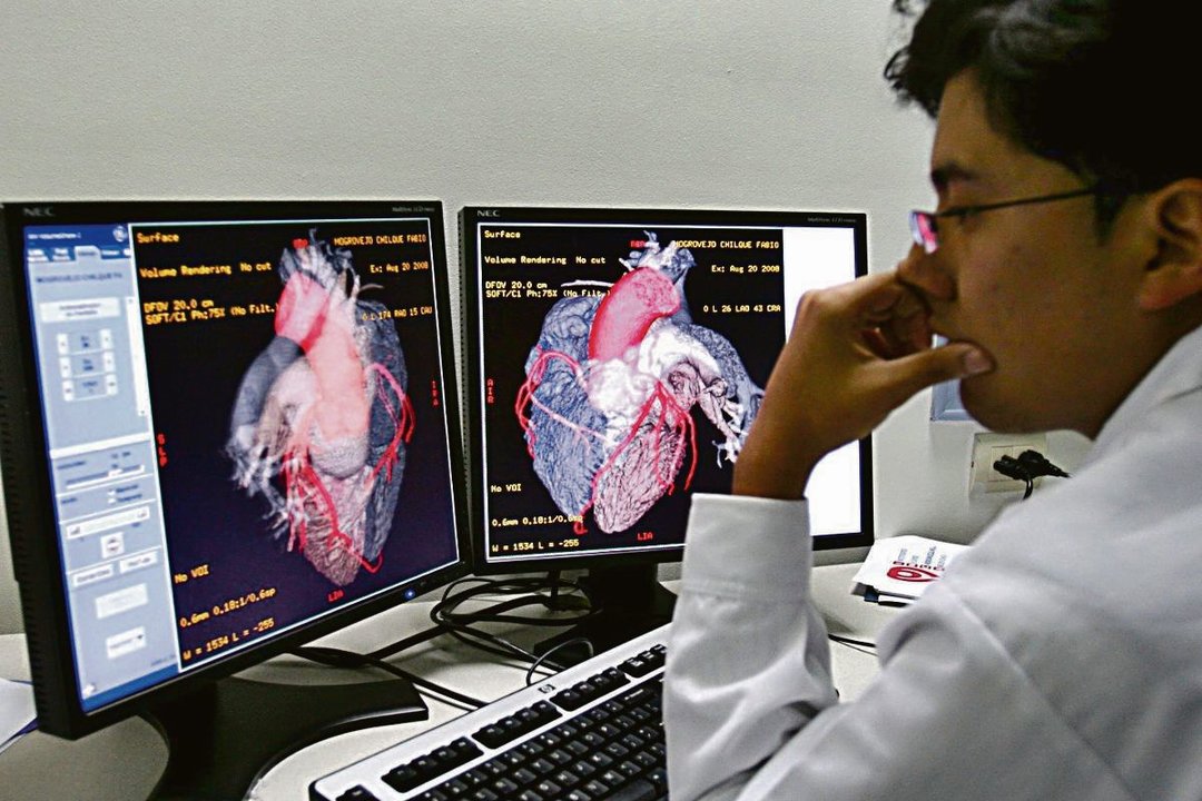 Un médico analiza datos de cirugía cardiovascular.