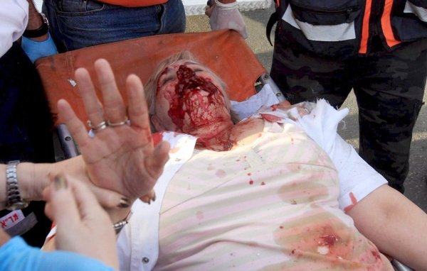 Una mujer herida tras el impacto de un cohete Grad en un centro comercial de la ciudad israelí de Ashkelon.