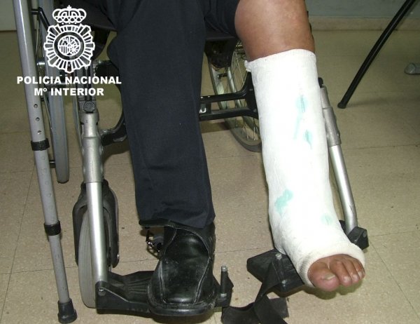 La Policía cree que la lesión de la pierna fue intencionada. (Foto: EFE)