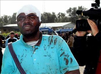 Un inmigrante africano que fue golpeado por miembros del clan mafioso Bellocco. (Foto: Tony Vece)