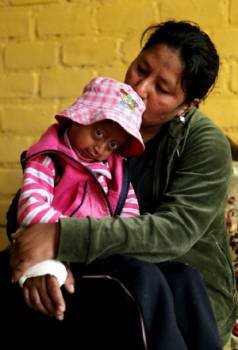 Mariella, una niña de 7 años que padece la enfermedad de la progeria o vejez prematura, junto a su madre, Kaythy de La Cruz, en su humilde casa en el distrito Villa El Salvador en Lima, Perú. EFE