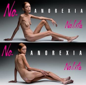 Isabelle Caro en una campaña publicitaria contra la anorexia
