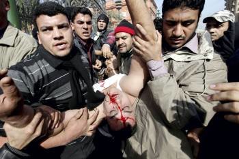 Los manifestantes llevan a un joven que resultó herido durante los enfrentamientos. (Foto: KHALED ELFIQI)