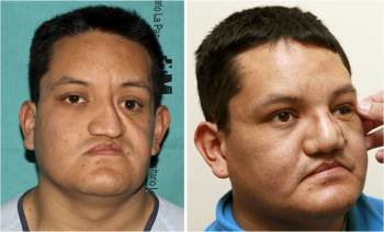 Imágenes del paciente tomadas antes (izquierda) y después de la operación. (Foto: J. J. GUILLÉN)
