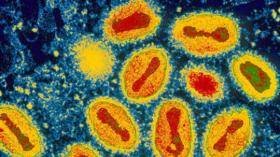 Imagen del virus de la viruela (Foto: EFE)