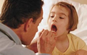 La extirpación de las anginas es frecuente en niños con problemas de garganta. (Foto: ARCHIVO)