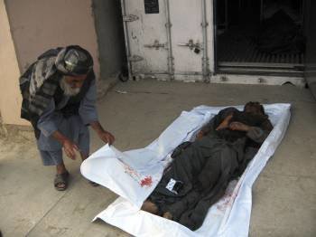 Un trabajador de la morgue del hospital muestra el cuerpo de Sardar Mohammad Karzai. (Foto: SAMEEN. EFE)