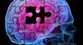 La reducción del espesor de ciertas áreas de la corteza cerebral es un indicador de Alzheimer (Foto: EFE)