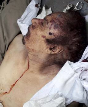 El cadáver del líder libio Muamar el Gadafi. (Foto: GUILLEM VALLE)