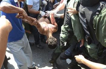 Uno de los heridos es sacado del penal por policías y servicios médicos. (Foto: RAFAEL RODRÍGUEZ)