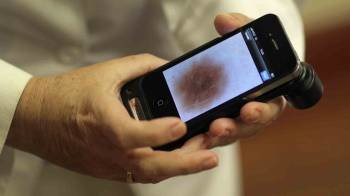 Un dispositivo smartphone podría ayudar a realizar un diagnóstico precoz. (Foto: ARCHIVO)