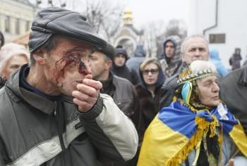 Un manifestante herido en las manifestaciones proeuropeas de Kiev. (Foto: SERGEI DOLZHENKO)
