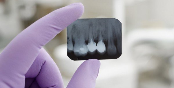 Científicos descubren una forma de hacer que renazcan dientes perdidos