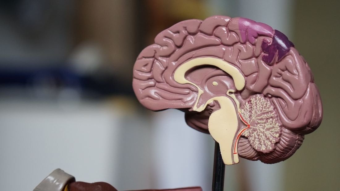 Modelo de un cerebro humano. (Foto: Unsplash)