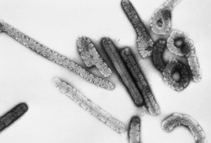 Virus de Marburgo. Foto: Wikipedia.