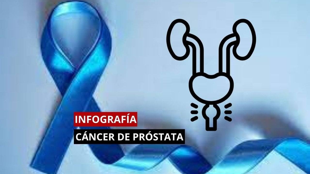 Infografía sobre el cáncer de próstata.