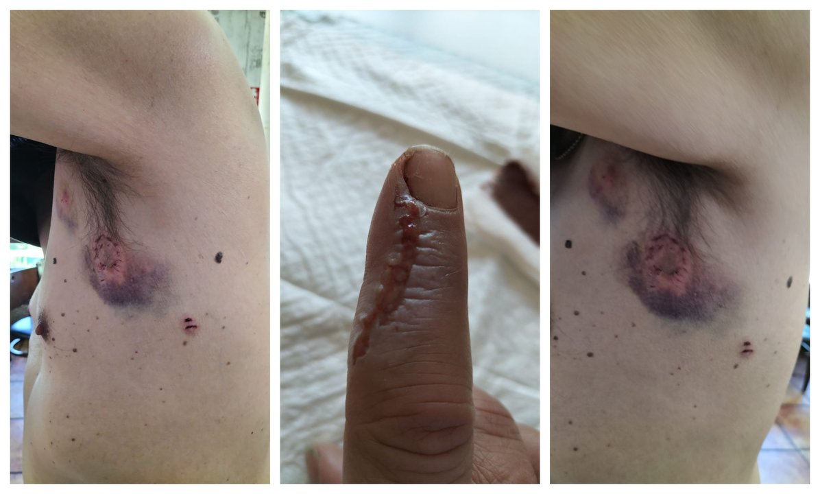 Las fotos de las heridas sufridas tras la agresión.