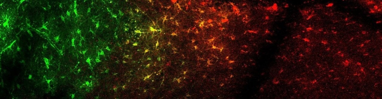 Nuevo tipo de célula del cerebro, "Astrocitos glutamatérgicos"