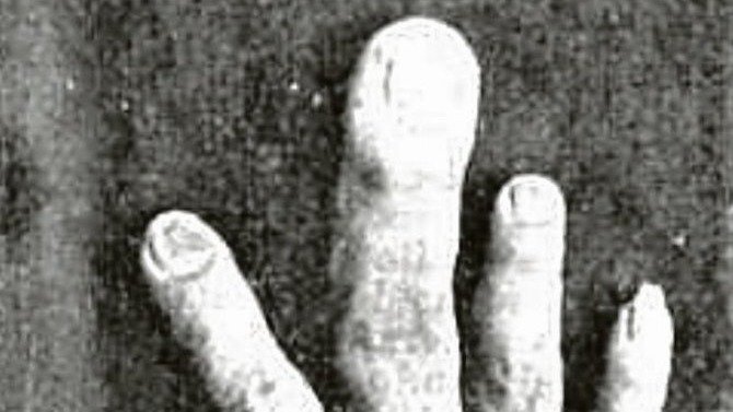 Caras y Caretas nº172. El dedo de José Losada.